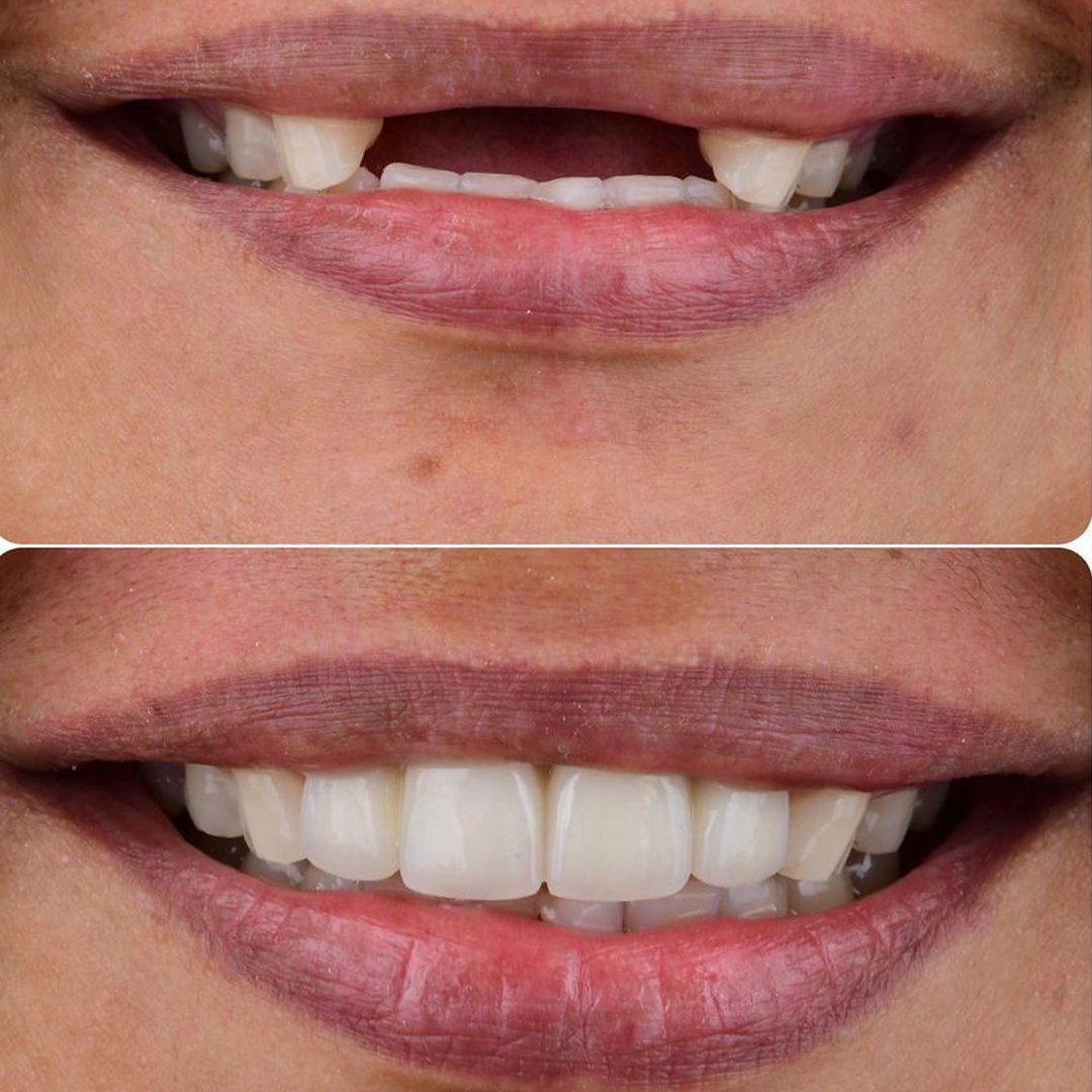 antes-e-depois-2.jpg