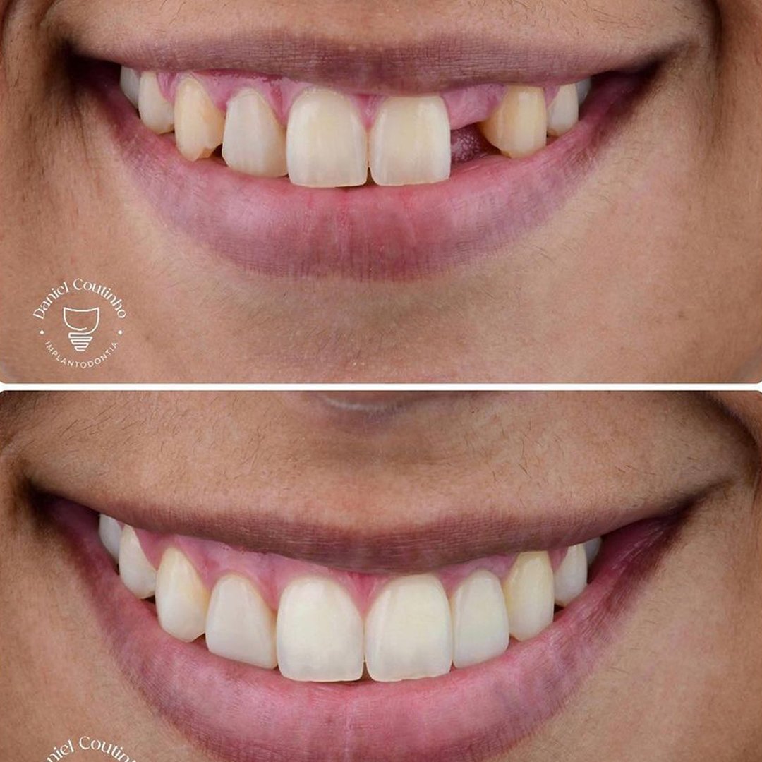antes-e-depois-3.jpg