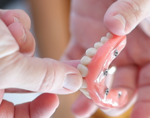 Chega de Dentadura: Como Trocar a Prótese Móvel por Implantes Fixos