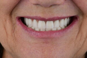 Por que Considerar o Dr Daniel Coutinho, um Dentista com 20 anos de Experiência?