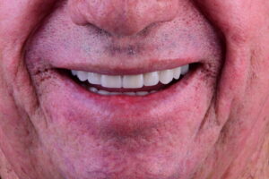 Prevenção odontológica: o hábito simples que muda o futuro do seu sorriso