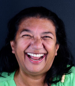 Coloquei Meus Implantes, e Agora?