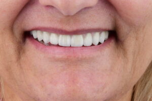 A Cultura do Desvalor: Quando o Sorriso se Torna Silêncio