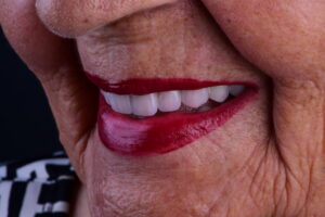 Quanto Vale um Sorriso Completo?