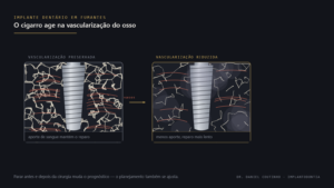 Comparação entre osso com vascularização preservada e osso com vascularização reduzida ao redor de um implante dentário, representando o efeito do cigarro