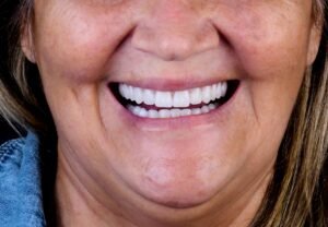 Close fotográfico de uma mulher sorrindo