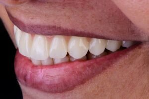 Close fotográfico de um sorriso