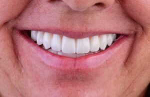 Close fotográfico de um sorriso