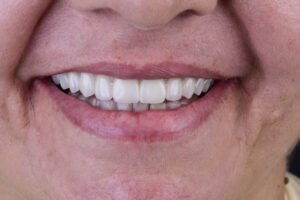 Close fotográfico de um sorriso