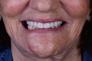 Close fotográfico de um sorriso
