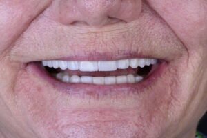 Close fotográfico de um sorriso