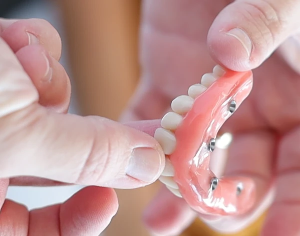 Os maiores medos do implante dentário respondidos com franqueza clínica