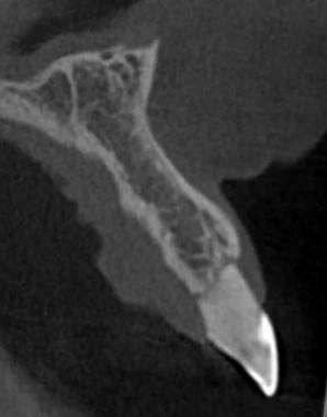 Exames odontológicos: radiografia panorâmica sendo analisada