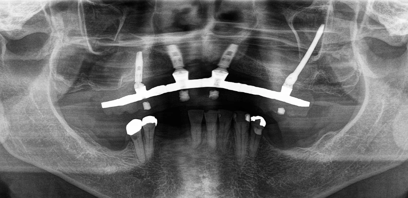 Tomografia entre os exames odontológicos essenciais
