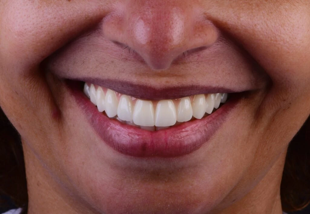 Close fotográfico de um sorriso