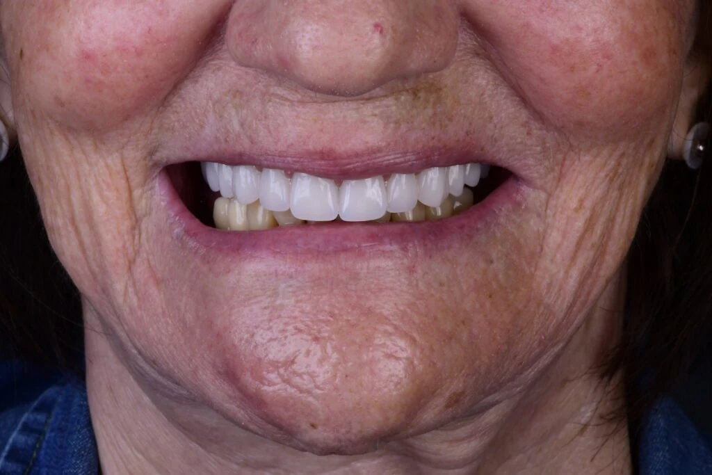 Close fotográfico de um sorriso